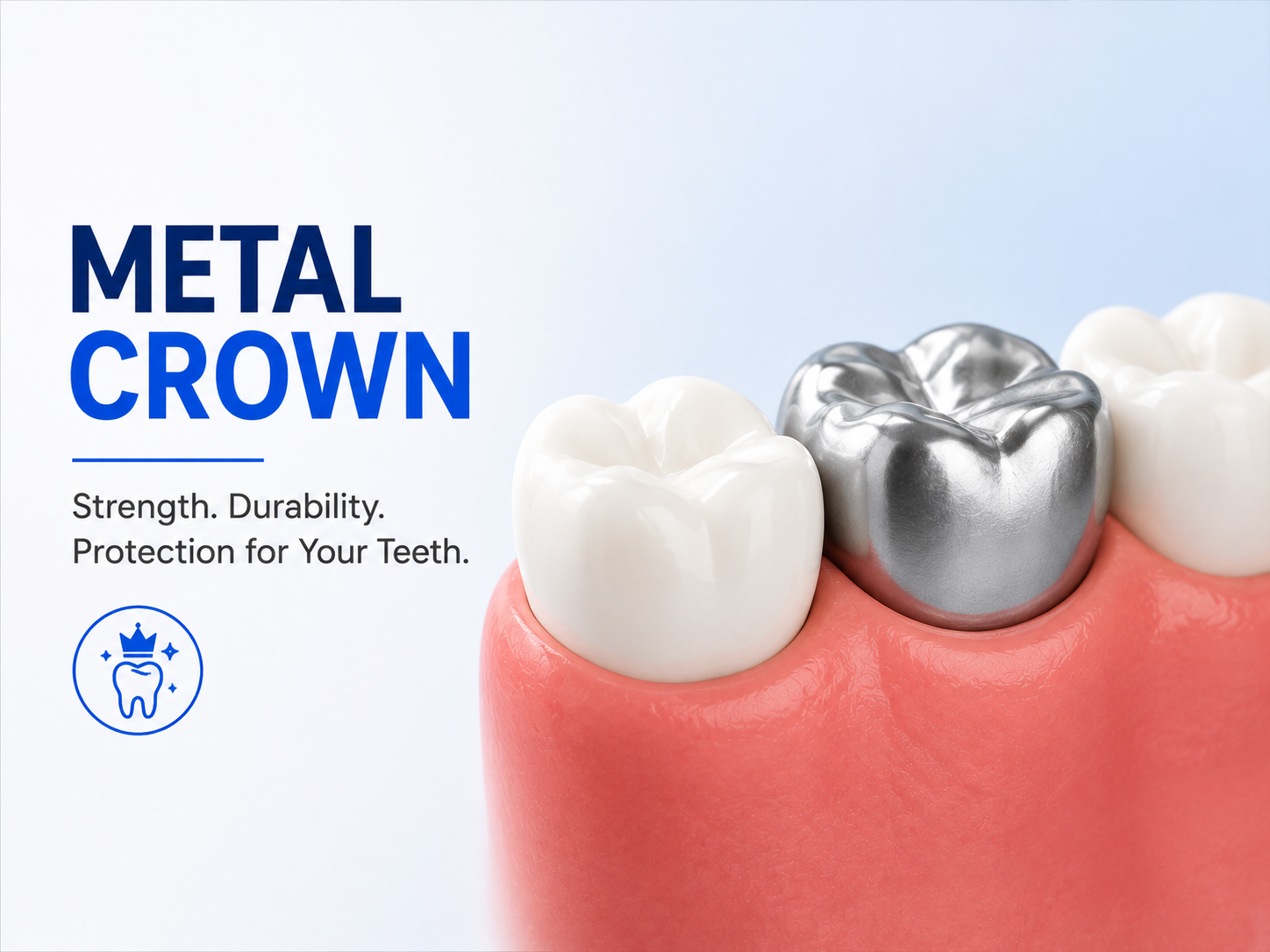 Metal Crown: A Strong and Durable Solution for Damaged Teeth