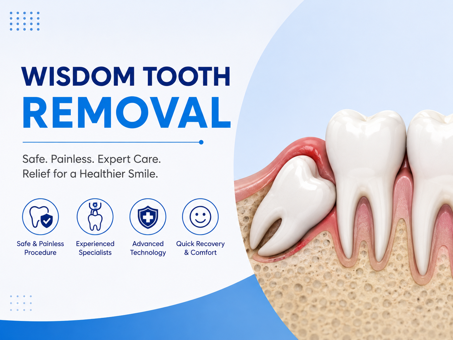 Wisdom Tooth Removal/Extraction